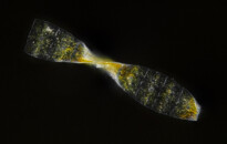 Planktonium – Short film and photo series about the unseen world of living microscopic plankton
Helicotheca tamesis (diatom)
Photo Jan van IJken