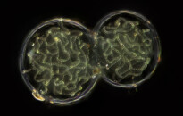 Planktonium – Short film and photo series about the unseen world of living microscopic plankton
Nostoc (cyanobacteria)
Photo Jan van IJken