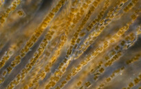 Planktonium – Short film and photo series about the unseen world of living microscopic plankton
Tube-dwelling diatoms
Photo Jan van IJken