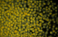 Planktonium – Short film and photo series about the unseen world of living microscopic plankton
Synura uvella (golden algae)
Photo Jan van IJken